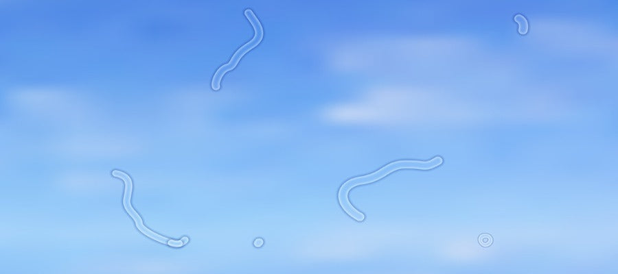 eye floaters on blue sky
