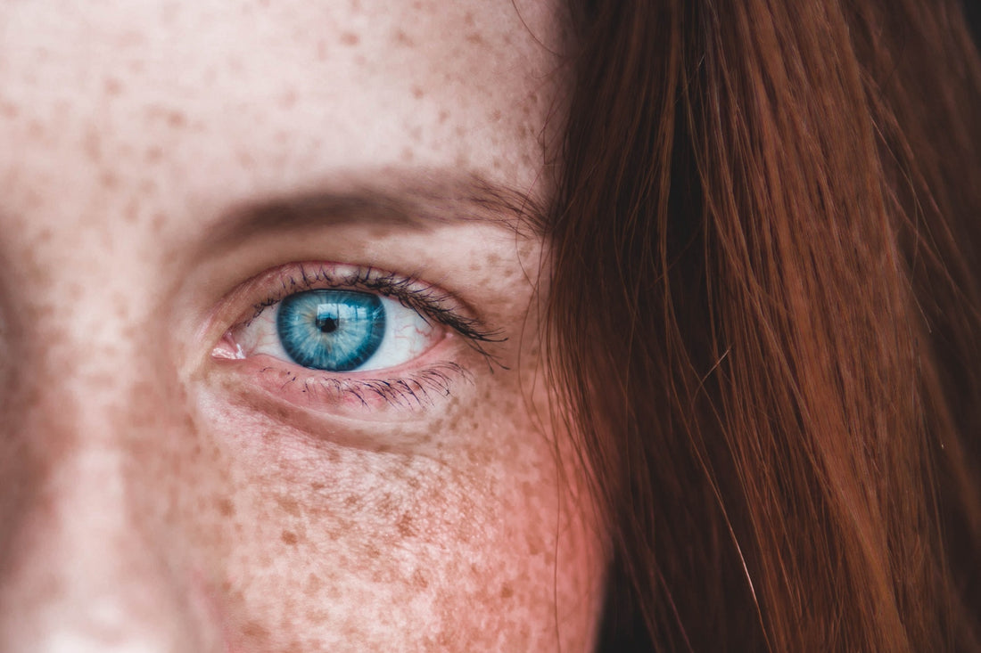 closeup of blue eye of woman with freckled face
