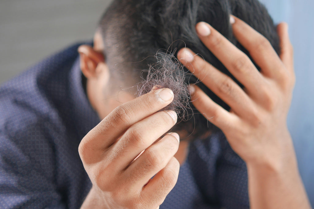 How to Prevent Hair Loss: 7 Realistic Tips